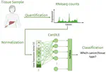 CanDLE: Illuminating Biases in Transcriptomic Pan-Cancer Diagnosis