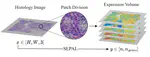 SEPAL: Spatial Gene Expression Prediction from Local Graphs